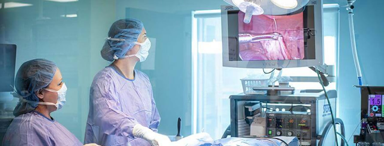 Image hover effect image